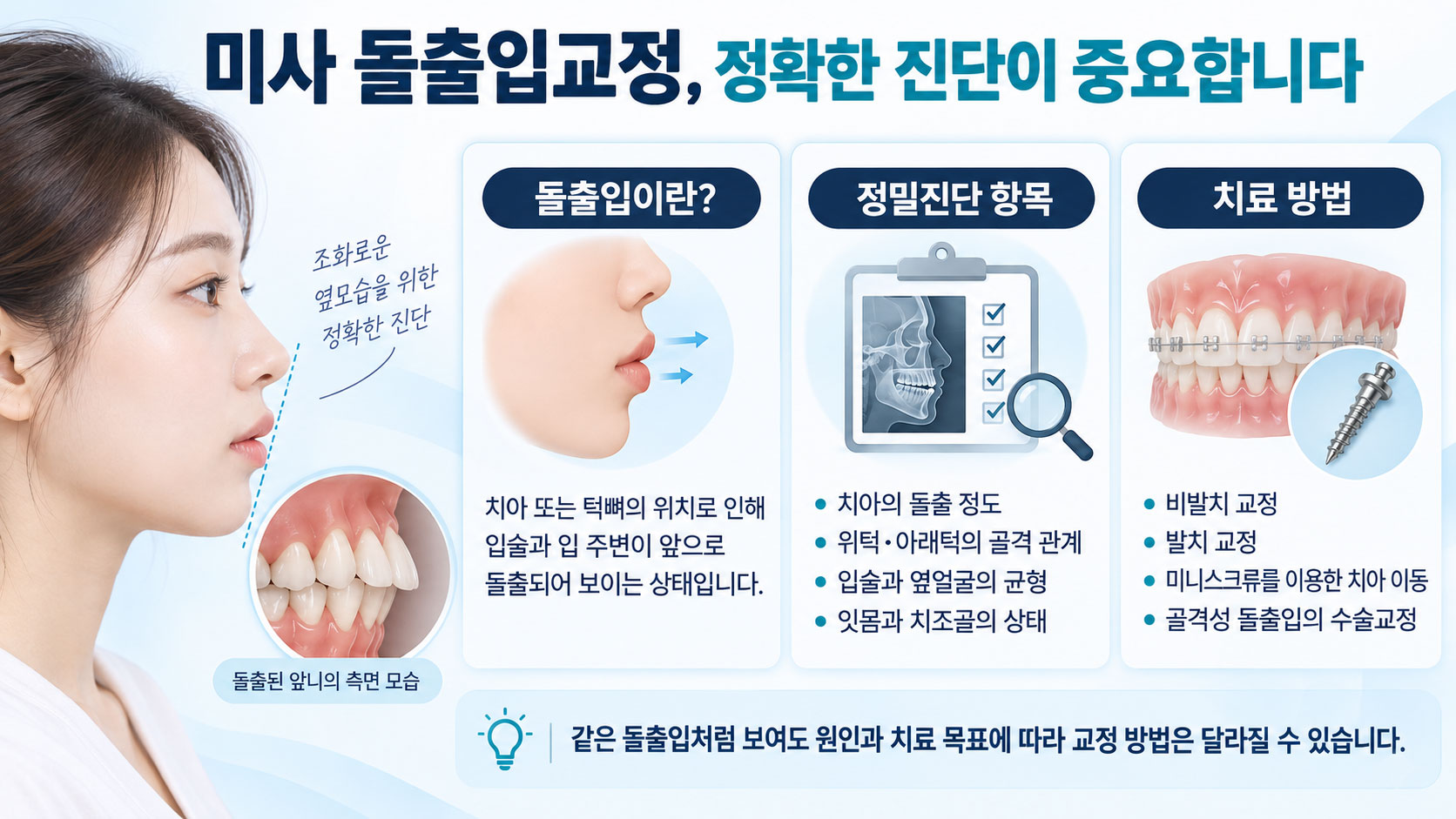 미사돌출입교정 365플러스치과 치아성 골격성 돌출 원인 구분 진단 설명
